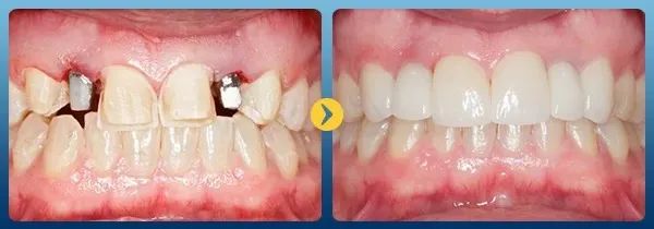 Hình ảnh nổi bật tại Nha Khoa Quốc Tế An Bình – Khoảnh khắc chăm sóc nụ cười