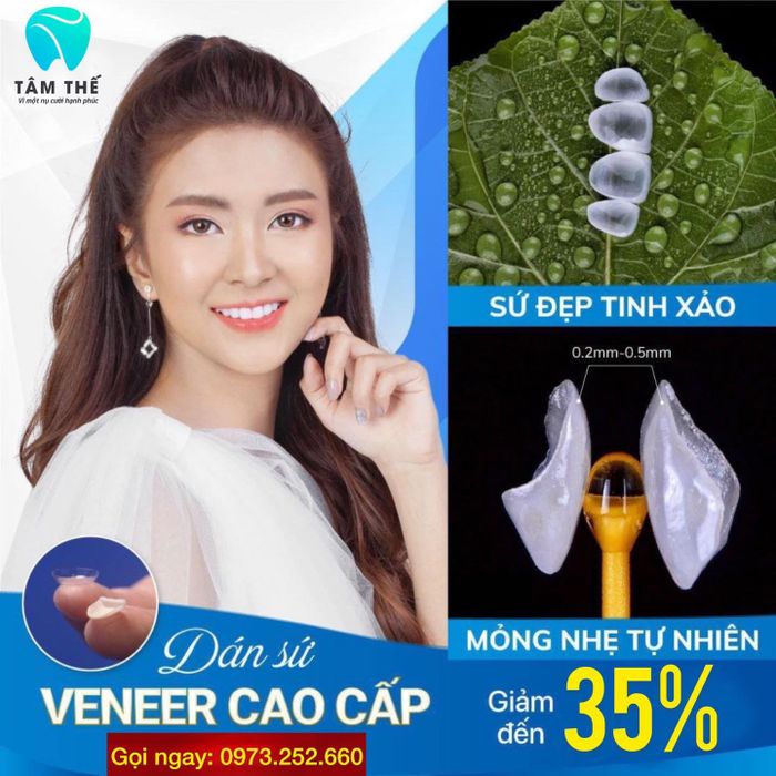 Hình ảnh chân thực về không gian hiện đại và dịch vụ chuyên nghiệp tại Nha khoa Tâm Thế Đà Lạt