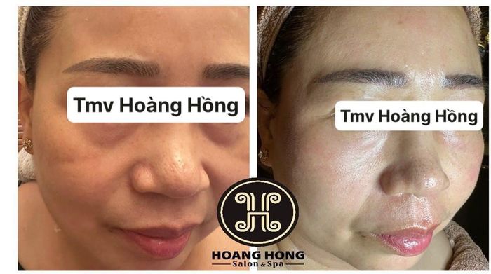 Không gian sang trọng và hiện đại tại Thẩm Mỹ Viện Hoàng Hồng