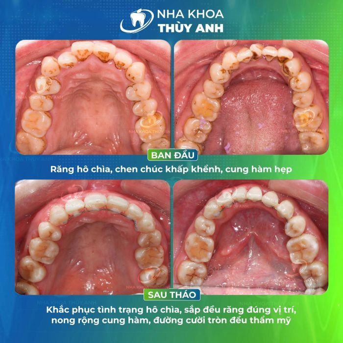 Nha Khoa Thùy Anh - Hình ảnh nổi bật 1
