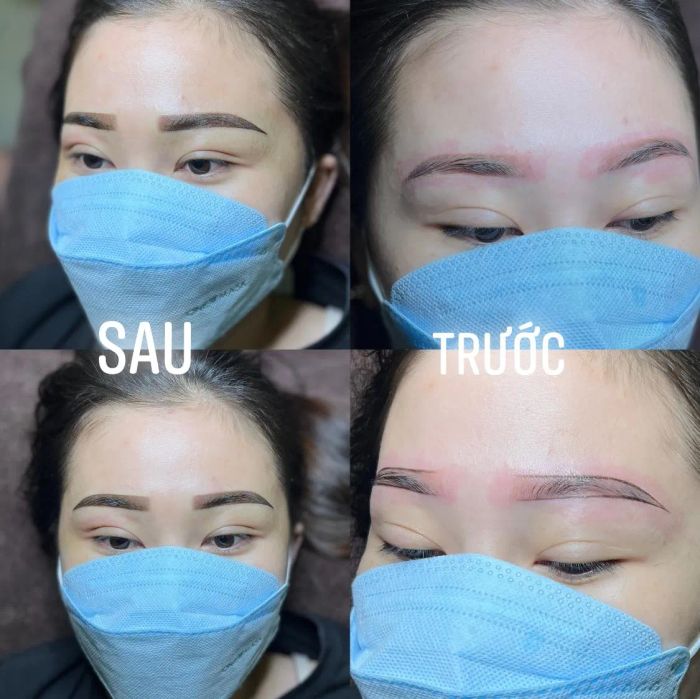 Thẩm Mỹ Viện Kim Khuyên Cần Thơ - Ảnh 2