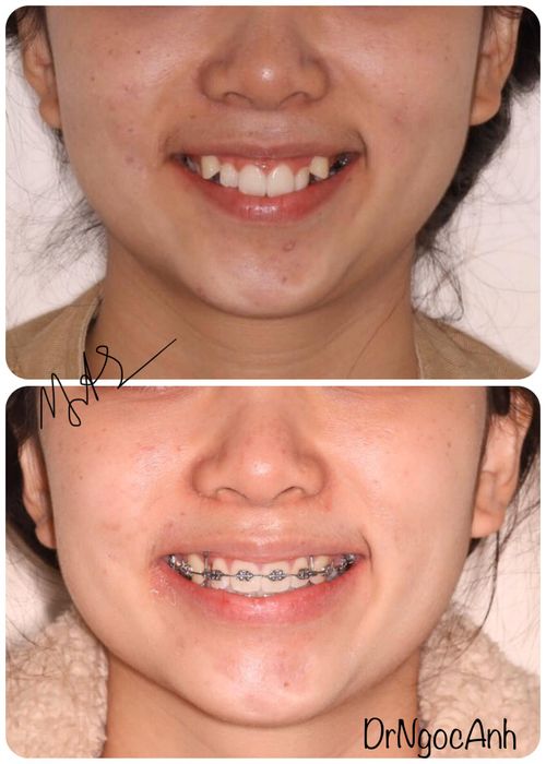 Hình ảnh phòng khám và đội ngũ bác sĩ tại Nha Khoa Anh Dũng