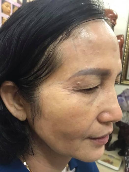 Hệ thống máy móc hiện đại tại Phòng khám Da Liễu 234 Quang Trung - Hình ảnh phòng trị liệu