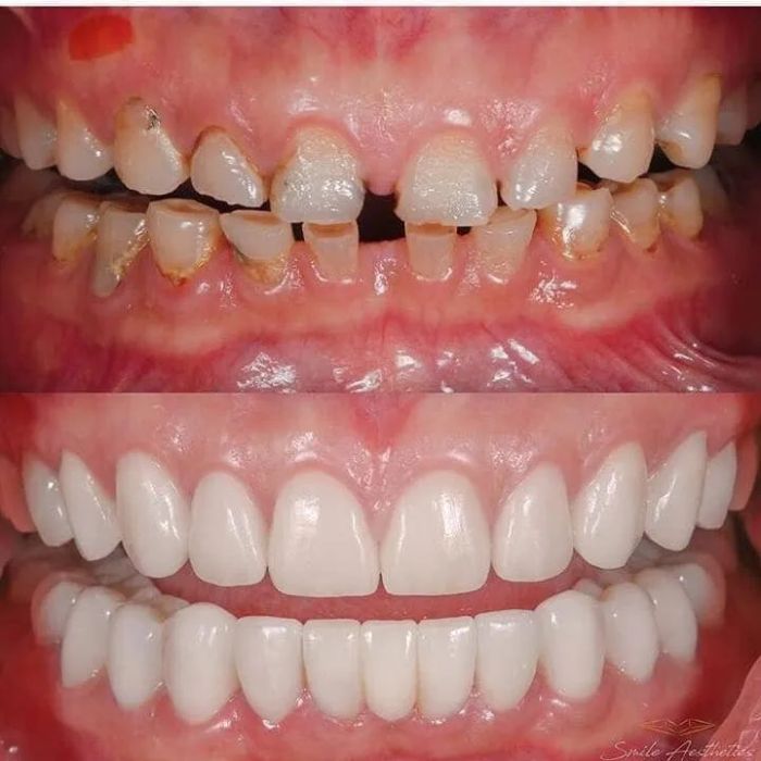 Khoảnh khắc dịch vụ tại Nha Khoa Quốc Tế An Bình ảnh 2 – Nơi khởi đầu cho sự tự tin