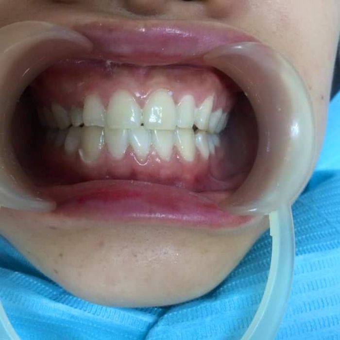 Không gian sang trọng và hiện đại tại Nha khoa Sài Gòn - Nơi gửi gắm niềm tin cho nụ cười tỏa sáng