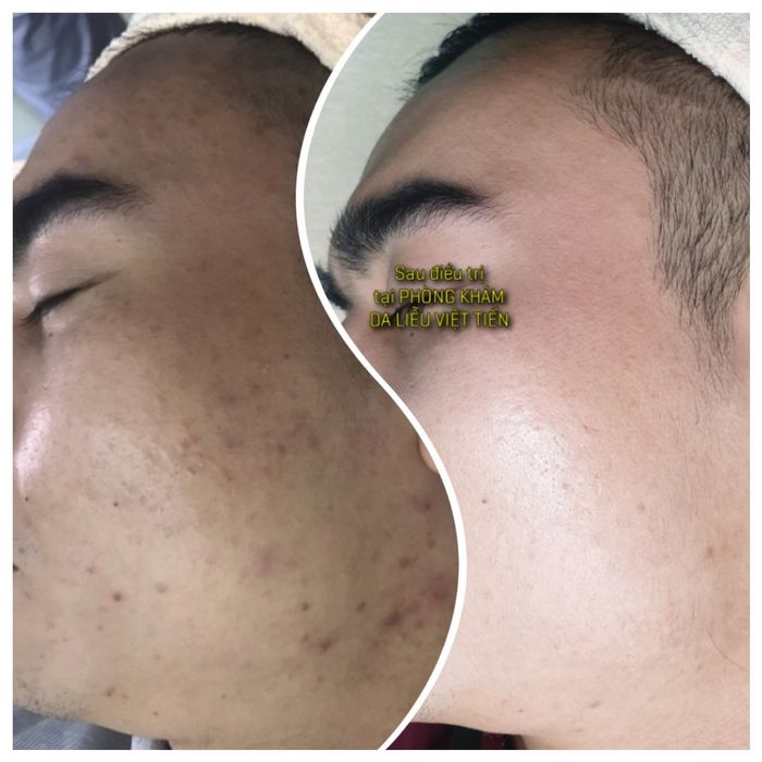 Hình ảnh thực tế Phòng khám da liễu Việt Tiến - góc chụp số 2