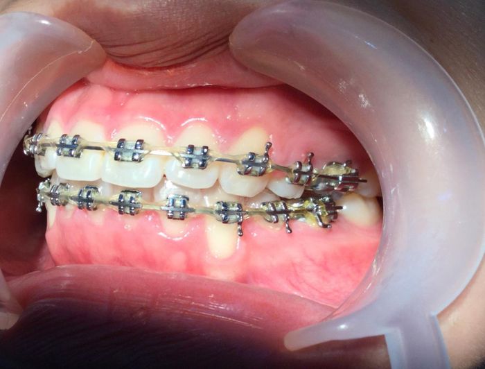 Hình ảnh thực tế về cơ sở vật chất tại Nha Khoa VẠN MỸ - Gia Lai