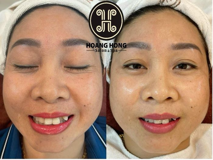 Hình ảnh phòng điều trị chuẩn y khoa tại Thẩm Mỹ Viện Hoàng Hồng