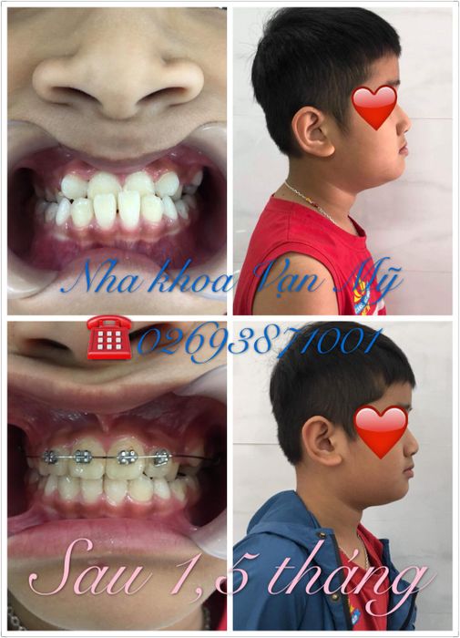 Hình ảnh thực tế tại Nha Khoa VẠN MỸ - Gia Lai