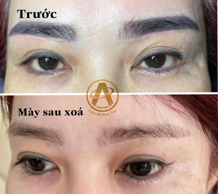 Thẩm Mỹ Anna Tran - Ảnh 1