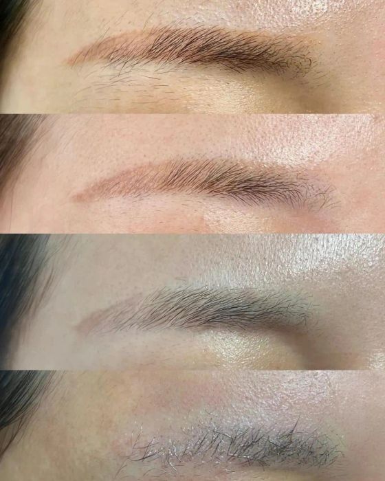 Thẩm Mỹ Viện Kim Khuyên Cần Thơ - Ảnh 1