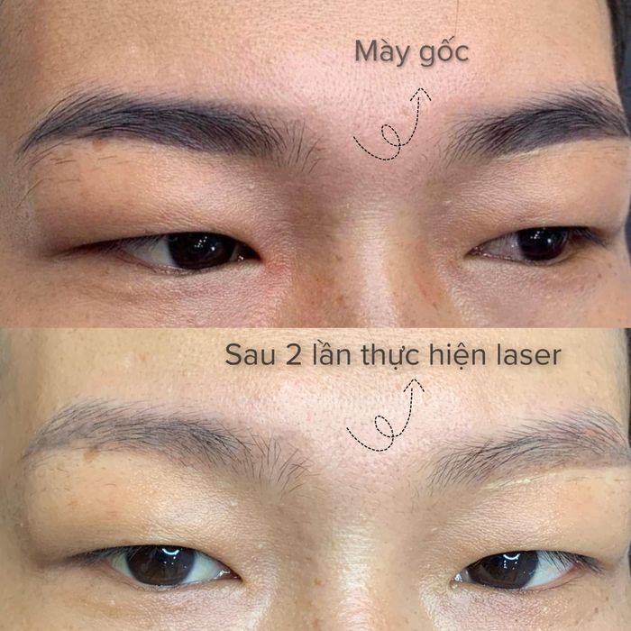 Vy Trương - Phun Xăm Thẩm Mỹ Chuyên Nghiệp ảnh 1
