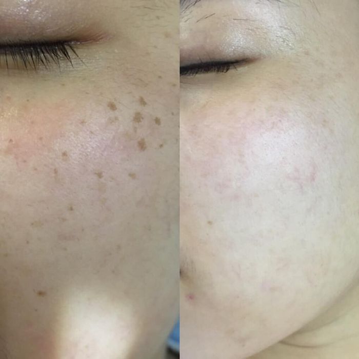 Hình ảnh thực tế Phòng khám da liễu - Laser thẩm mỹ