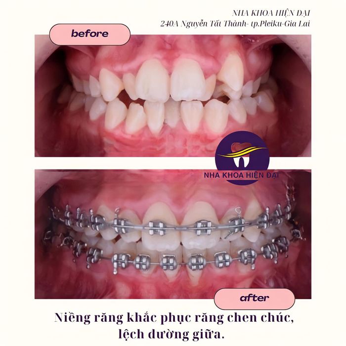 Hình ảnh cơ sở vật chất hiện đại tại Nha Khoa Hiện Đại - Gia Lai