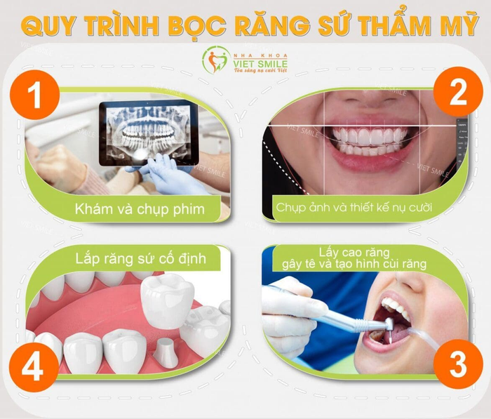 Hình ảnh thực tế tại Nha khoa Việt Smile - Nơi trao gửi nụ cười tỏa sáng