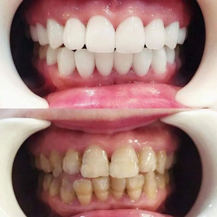 Hệ thống trang thiết bị tiên tiến tại Nha Khoa Á Châu (ảnh 2)