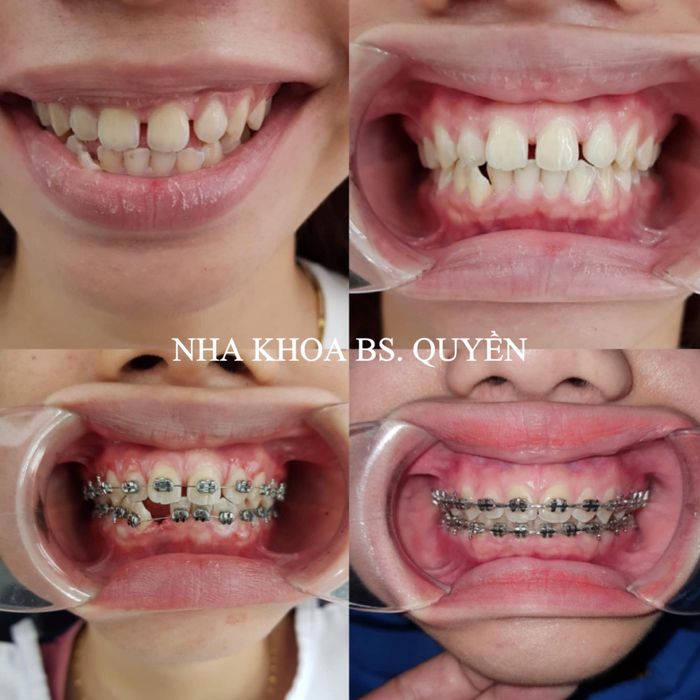 Hình ảnh thực tế Nha Khoa Bác Sĩ Quyền - Không gian hiện đại