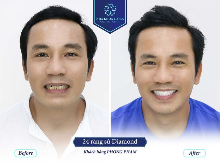 Hình ảnh phòng Lab Nha Khoa Flora - Công nghệ chế tác răng sứ đỉnh cao