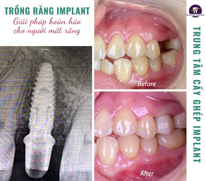 Hình ảnh đội ngũ bác sĩ chuyên môn cao tại Nha Khoa Hiện Đại