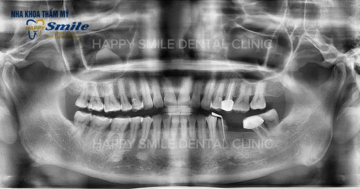 Hình ảnh không gian hiện đại tại Nha Khoa HAPPY Smile