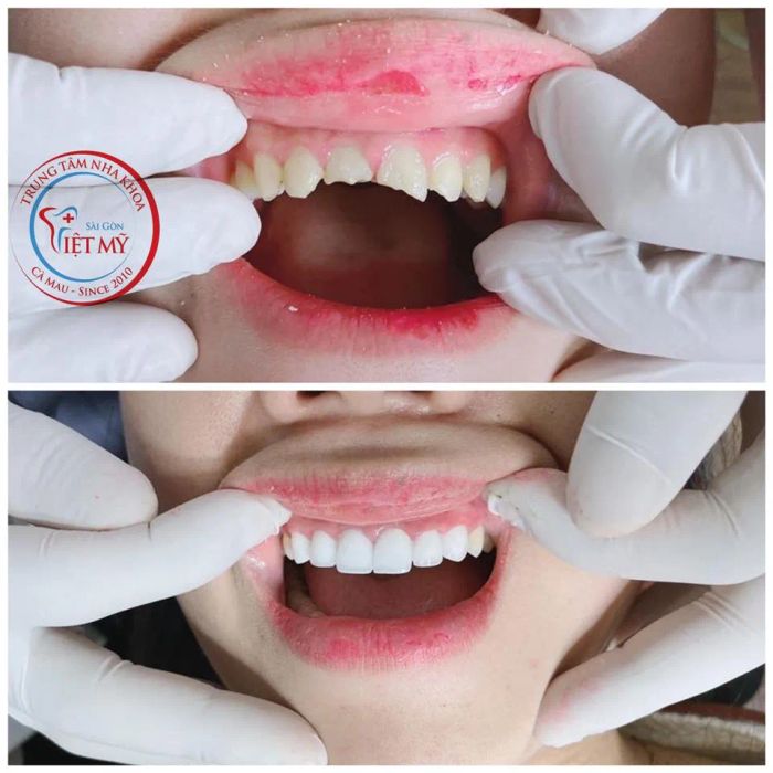 Hình ảnh phòng khám đạt chuẩn quốc tế tại Nha Khoa Sài Gòn Việt Mỹ