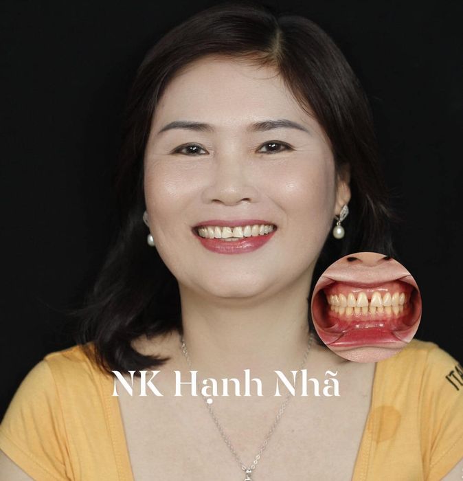 Hình ảnh thực tế về không gian hiện đại tại Nha Khoa Hạnh Nhã