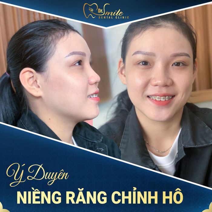 Không gian hiện đại tại Nha Khoa Dr.Smile
