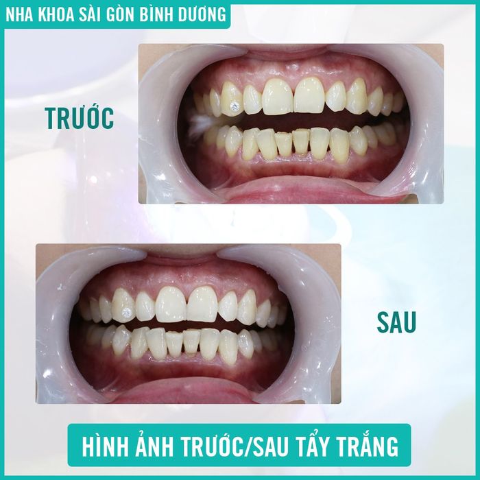 Không gian hiện đại tại Nha Khoa Sài Gòn Bình Dương