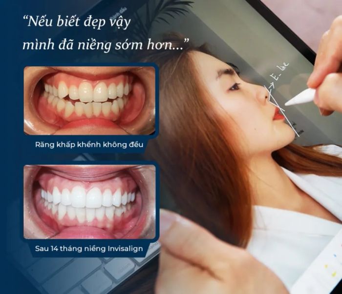 Hình ảnh Nha Khoa Pháp Việt Tô Ký