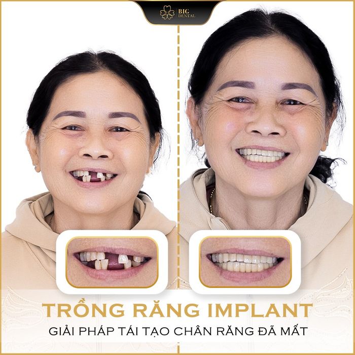 Hình ảnh phòng khám tiêu chuẩn quốc tế tại Nha Khoa Big Dental