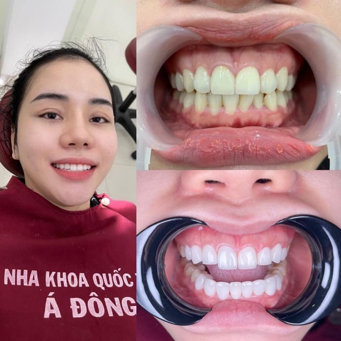 Hình ảnh đội ngũ bác sĩ chuyên môn cao tại Nha Khoa Á Đông