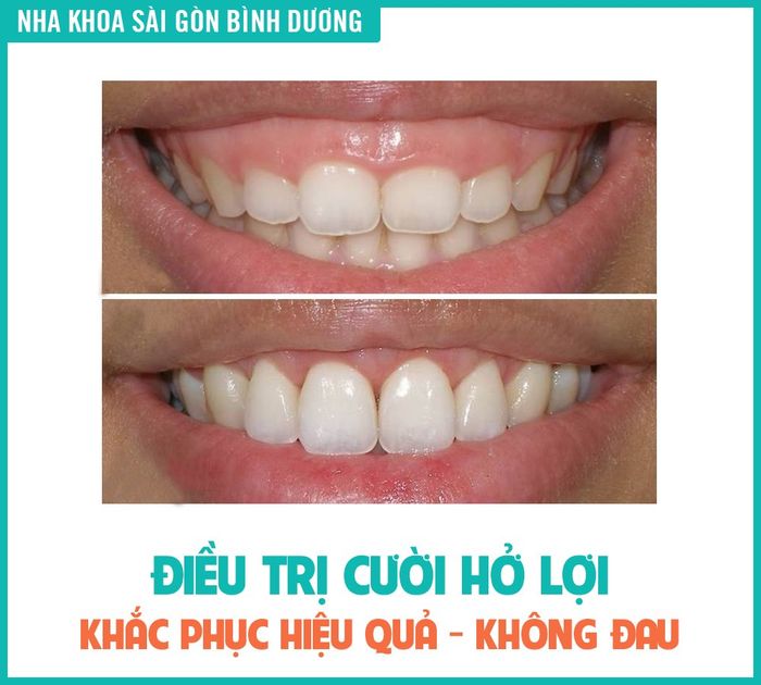 Hệ thống trang thiết bị tiên tiến tại Nha Khoa Sài Gòn