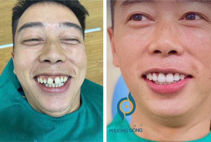 Không gian sang trọng và hiện đại tại Nha Khoa Phương Đông