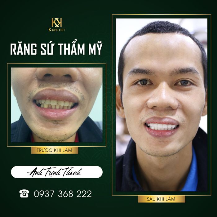Hệ thống phòng điều trị hiện đại tại Nha Khoa Quốc Tế K Dentist