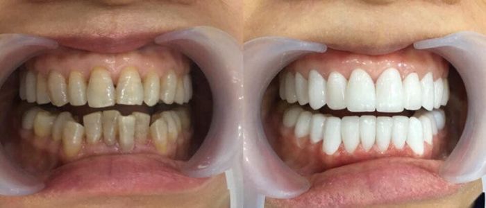 Không gian hiện đại tại Nha Khoa Tuyết Mai Hà Nội