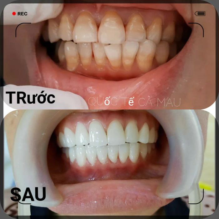 Hình ảnh đội ngũ bác sĩ chuyên gia tại Nha khoa Quốc tế Cà Mau