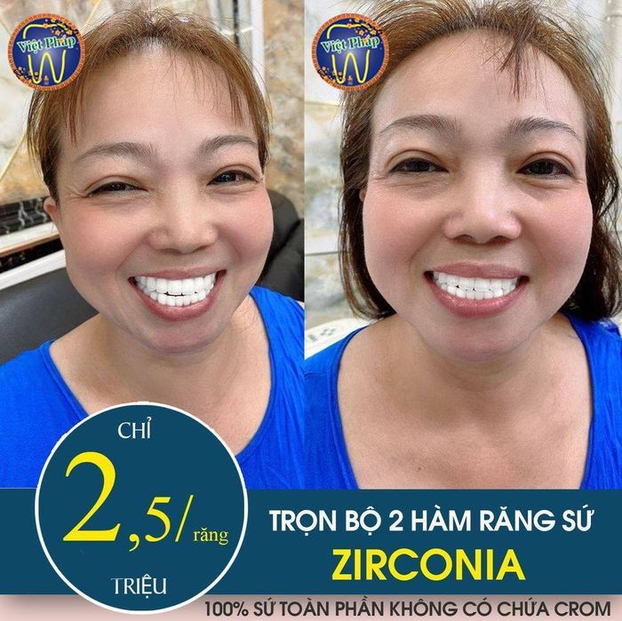 Hình ảnh thực tế Nha Khoa Việt Pháp