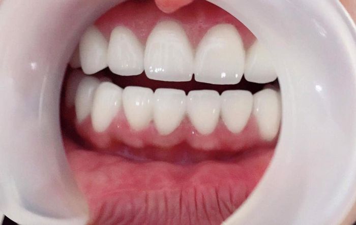 Hình ảnh không gian điều trị chuẩn quốc tế tại Nha Khoa Bảo Anh