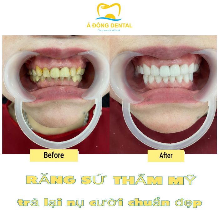 Hình ảnh phòng khám đạt chuẩn quốc tế tại Nha Khoa Á Đông