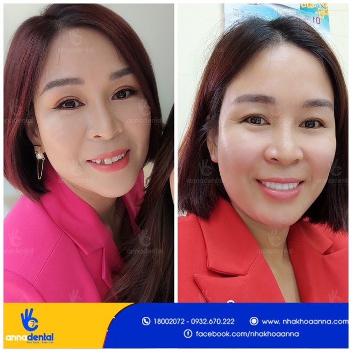 Không gian phòng khám sang trọng và hệ thống máy móc hiện đại tại Nha khoa Anna