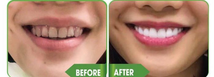 Nha khoa Ngọc Thanh ảnh 2 - Hình ảnh ghi lại khoảnh khắc bác sĩ tận tâm thăm khám và điều trị cho bệnh nhân.