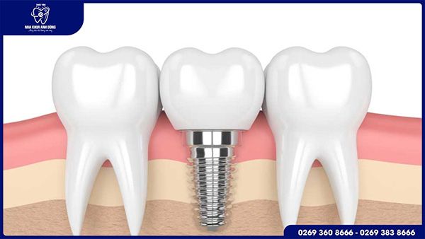 Hình ảnh phòng khám tiêu chuẩn quốc tế tại Nha Khoa Anh Dũng