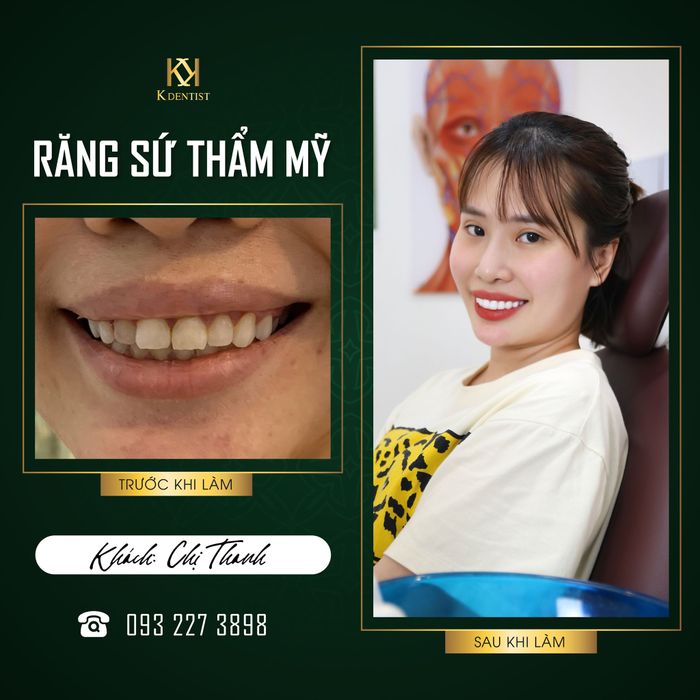 Không gian sang trọng tại Nha Khoa Quốc Tế K Dentist Quảng Ngãi