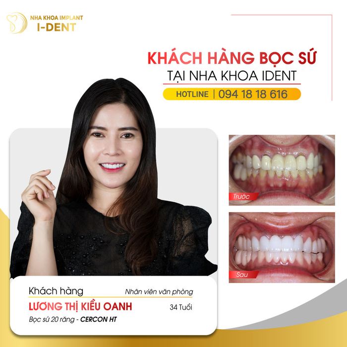 Không gian phòng khám hiện đại đạt chuẩn quốc tế tại Nha khoa I-Dent
