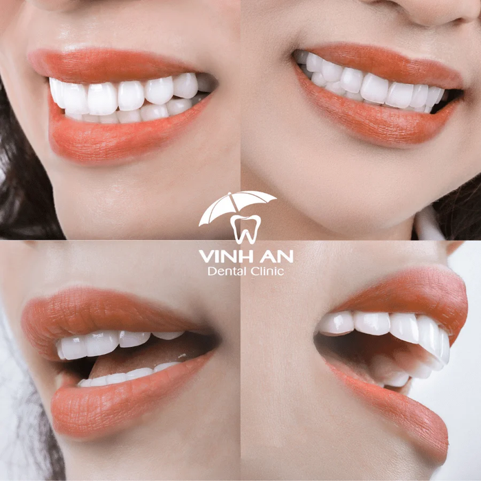 Không gian hiện đại và tiện nghi tại Nha khoa Vinh An qua hình ảnh thực tế