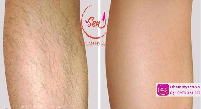 Hình ảnh phòng điều trị tiêu chuẩn 5 sao tại Thẩm mỹ Sen