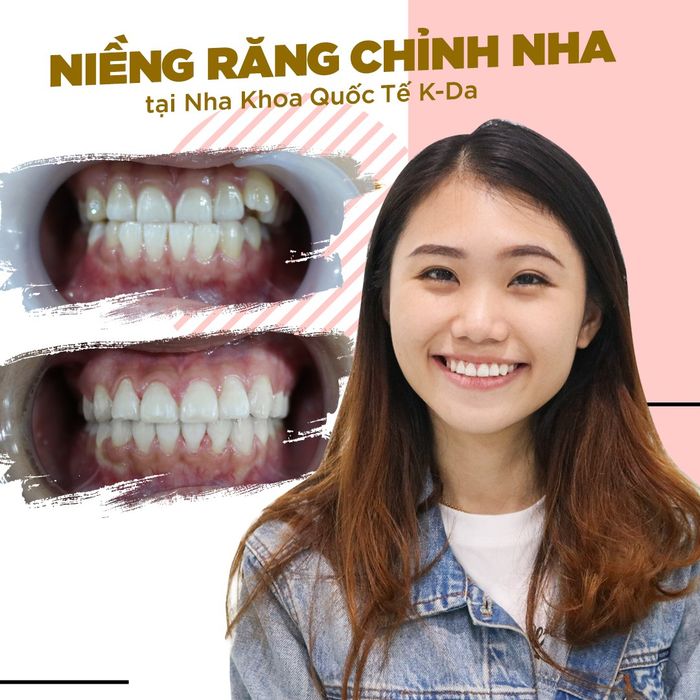 Nha Khoa Quốc Tế K-Da ảnh 2