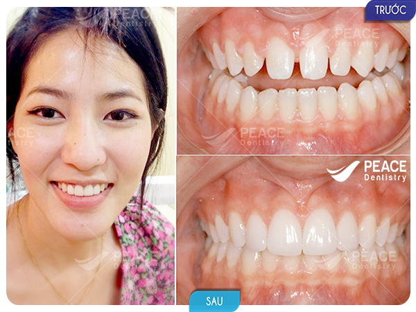 Không gian điều trị tiêu chuẩn 5 sao tại Nha khoa Peace Dentistry