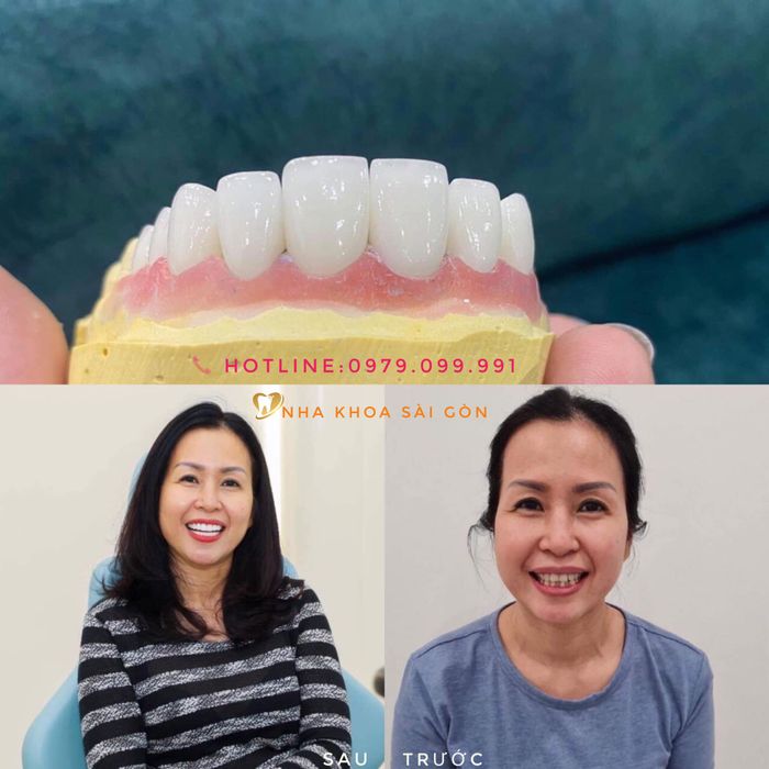 Hình ảnh Nha Khoa Sài Gòn Long Xuyên 1