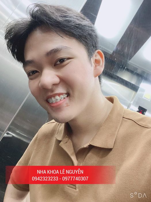 Nha khoa Lê Nguyễn ảnh 1
